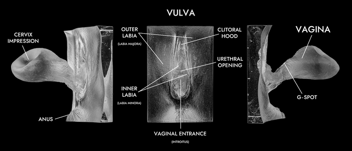 For posters and lovers of photos and videos of the vagina (vagina) - NSFW, Picture with text, Mat, Burnt, Longpost, Vagina, Labia, Clitoris, Pubis, Urethra, Erotic